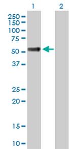 OSMR Antibody in Western Blot (WB)