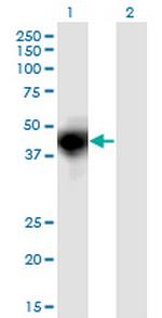 OSMR Antibody in Western Blot (WB)