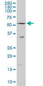 SLC33A1 Antibody in Western Blot (WB)