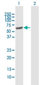 LGI1 Antibody in Western Blot (WB)