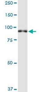 XPR1 Antibody in Western Blot (WB)