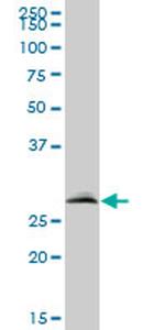 VAPB Antibody in Western Blot (WB)