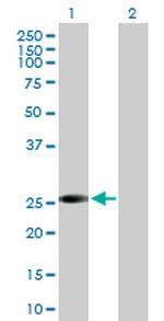 VAPB Antibody in Western Blot (WB)