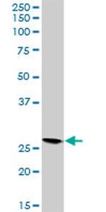 VAPB Antibody in Western Blot (WB)