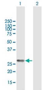 VAPA Antibody in Western Blot (WB)