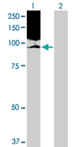 NOLC1 Antibody in Western Blot (WB)