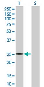 PTTG1 Antibody in Western Blot (WB)