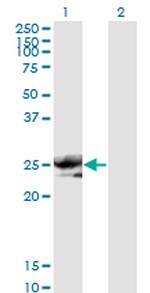 NOG Antibody in Western Blot (WB)