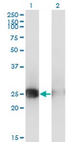 MSC Antibody in Western Blot (WB)