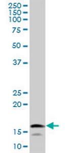 UBE2L6 Antibody in Western Blot (WB)