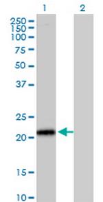 ITGB1BP1 Antibody in Western Blot (WB)