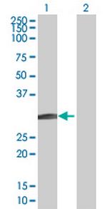 BCL7B Antibody in Western Blot (WB)