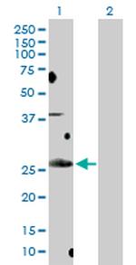 BCL7B Antibody in Western Blot (WB)