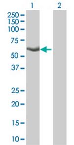 KLF4 Antibody in Western Blot (WB)