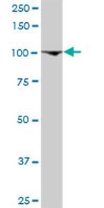 GTF3C3 Antibody in Western Blot (WB)