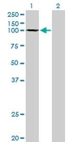 GTF3C3 Antibody in Western Blot (WB)