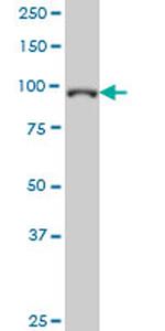 GTF3C3 Antibody in Western Blot (WB)