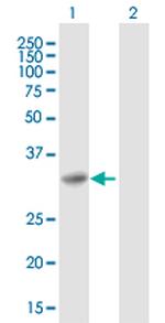 SNAP29 Antibody in Western Blot (WB)