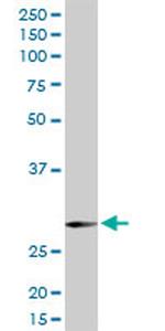 SNAP29 Antibody in Western Blot (WB)