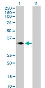 CER1 Antibody in Western Blot (WB)