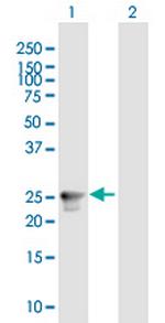 RAB33A Antibody in Western Blot (WB)