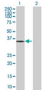 GRHPR Antibody in Western Blot (WB)