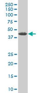 ZNF265 Antibody in Western Blot (WB)