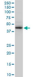 ZNF265 Antibody in Western Blot (WB)