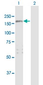 ARHGAP29 Antibody in Western Blot (WB)