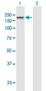 TJP2 Antibody in Western Blot (WB)