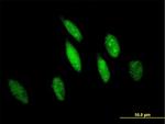 GSTO1 Antibody in Immunocytochemistry (ICC/IF)