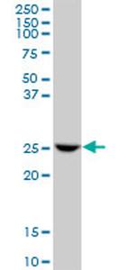 GSTO1 Antibody in Western Blot (WB)