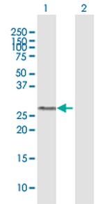 GSTO1 Antibody in Western Blot (WB)