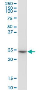 GSTO1 Antibody in Western Blot (WB)