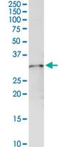 GSTO1 Antibody in Western Blot (WB)