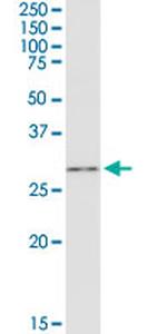 GSTO1 Antibody in Western Blot (WB)