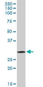 GSTO1 Antibody in Western Blot (WB)