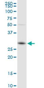 GSTO1 Antibody in Western Blot (WB)