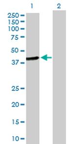 HOMER2 Antibody in Western Blot (WB)