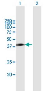 HOMER1 Antibody in Western Blot (WB)