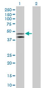 HOMER1 Antibody in Western Blot (WB)