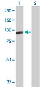 ARHGEF6 Antibody in Western Blot (WB)