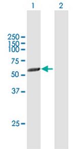 PICK1 Antibody in Western Blot (WB)