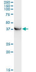 PRKCABP Antibody in Western Blot (WB)