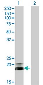 HAND2 Antibody in Western Blot (WB)