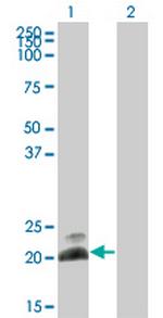 HAND2 Antibody in Western Blot (WB)