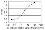 SH3BP5 Antibody in ELISA (ELISA)