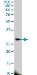 EIF4E2 Antibody in Western Blot (WB)