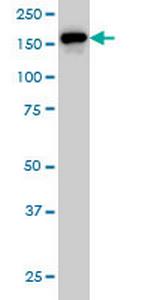 ROCK2 Antibody in Western Blot (WB)