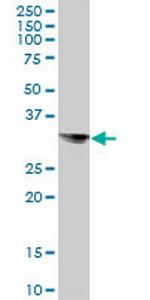 STX8 Antibody in Western Blot (WB)